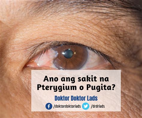 Ano ang sintomas ng sakit sa mata